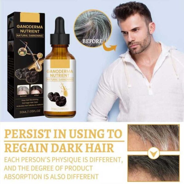 Anti greying Hair Serum Black Ganoderma Lucidum Black Hair Solutions 30ml - Image 2