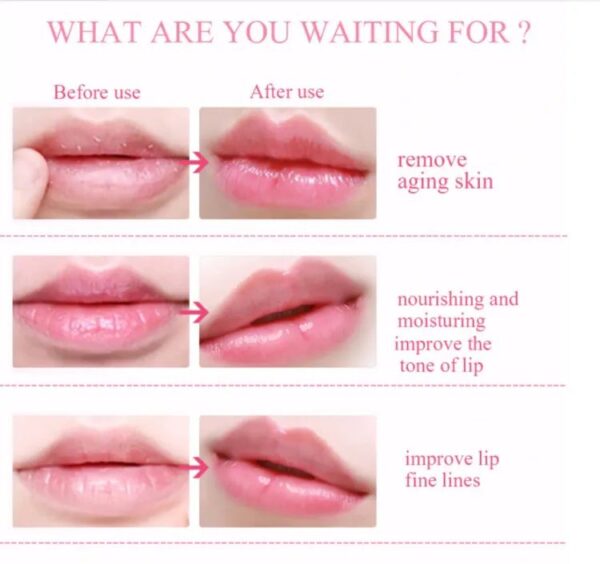 Lips mask Moisturizer For Lips Lips - Image 2