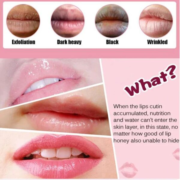 Lips mask Moisturizer For Lips Lips - Image 5