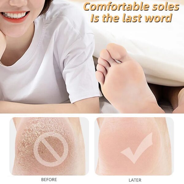 Full Cover Durable Elastic Hole Heel Protect Socks Insole Calluses Soft Silicone Pedicure Feet Care Moisturizing Anti Crack - Image 4