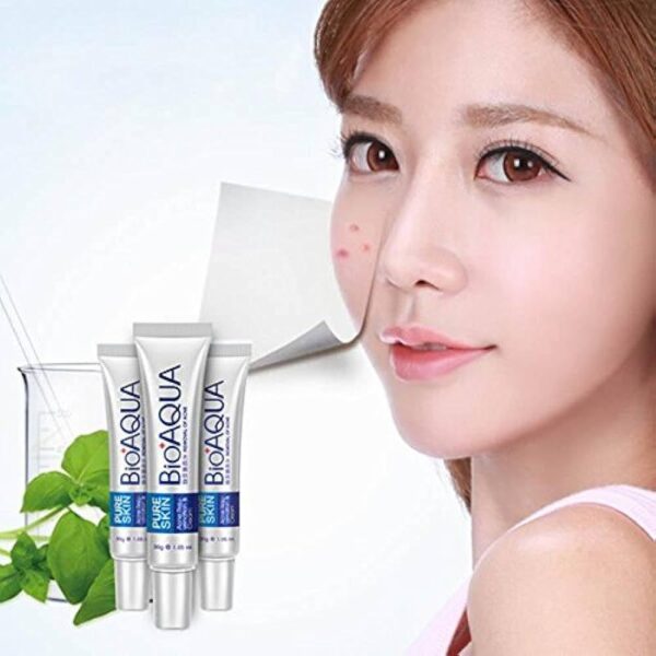 Bio aqua Acne Cream Face Skin Care Acne Anti-Wrinkle Removal Cream Spots Scar Blemish Marks 30g - Image 4