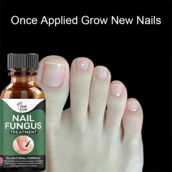 Nail Fungus Treatment Stop Fungal Growth Effective Fingernail 10ml - Image 2