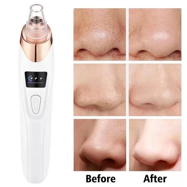 Upgraded Blackhead Remover Vacuum Facial Pore Cleaner Electric Acne Comedone Whitehead Extractor Tool 5 Probes For Women And Men - Image 7